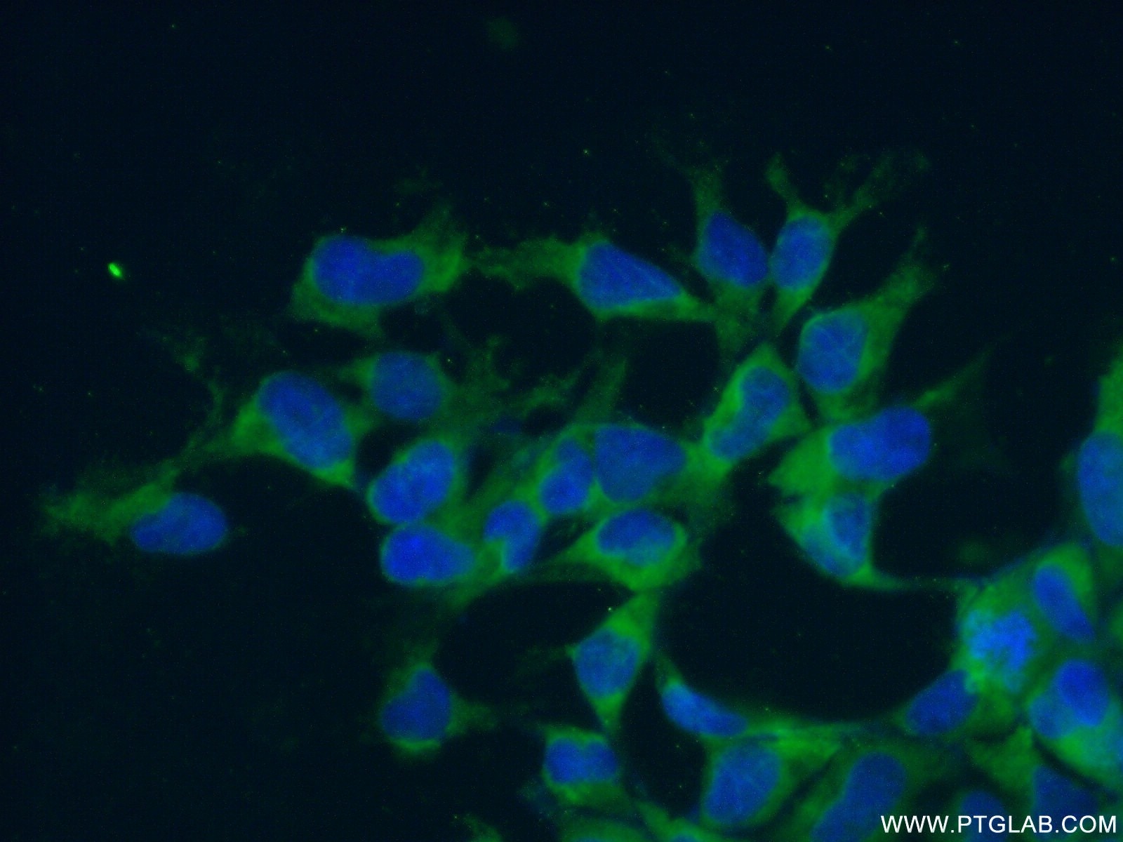 IF Staining of HEK-293 using 14583-1-AP