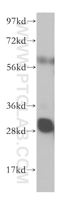 WB analysis of HEK-293 using 14583-1-AP