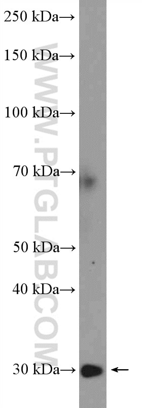 Western Blot (WB) analysis of rat kidney tissue using RPL7A Polyclonal antibody (15340-1-AP)