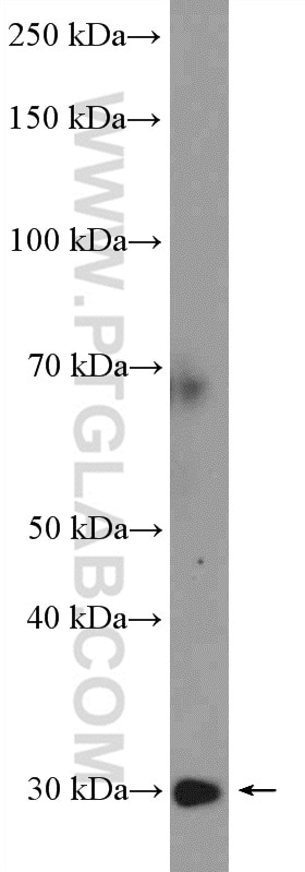 WB analysis of rat kidney using 15340-1-AP