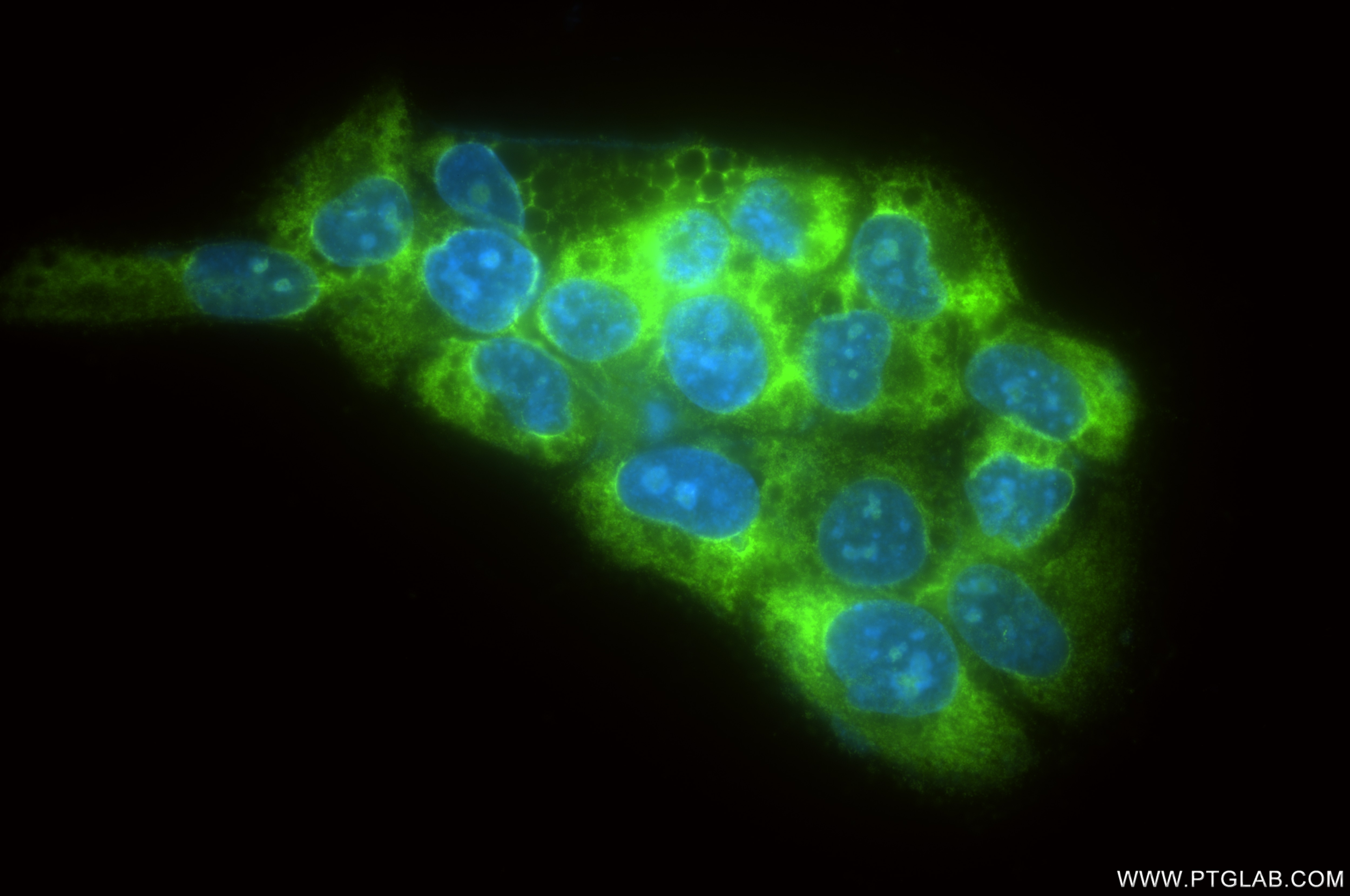 Immunofluorescence (IF) / fluorescent staining of HeLa cells using RPL7A Recombinant monoclonal antibody (86270-3-RR)