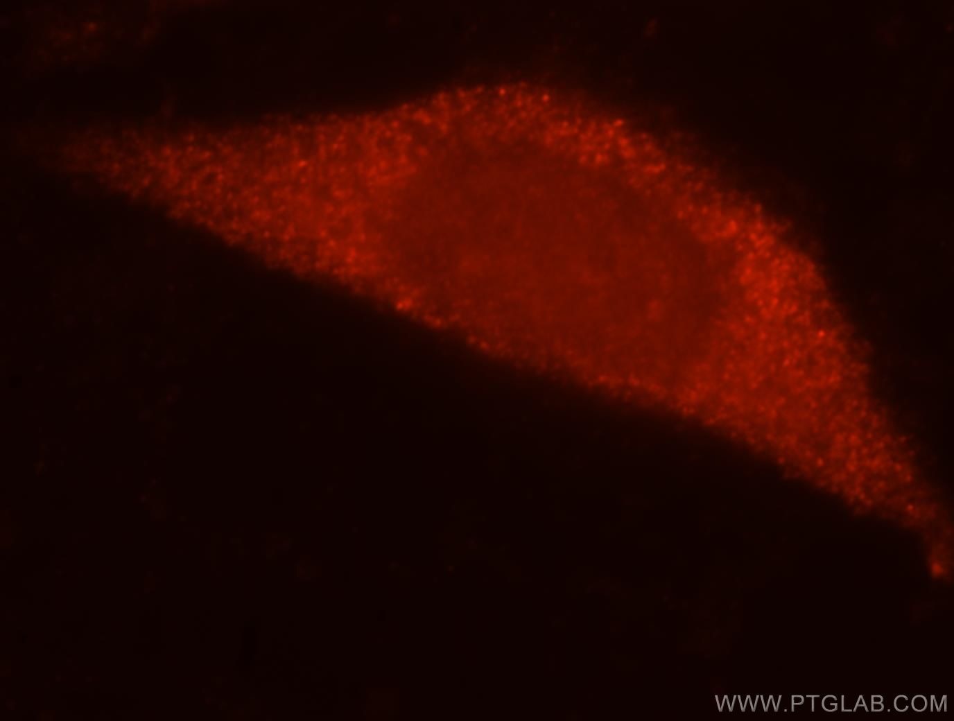 Immunofluorescence (IF) / fluorescent staining of MCF-7 cells using RPL7L1 Polyclonal antibody (16707-1-AP)