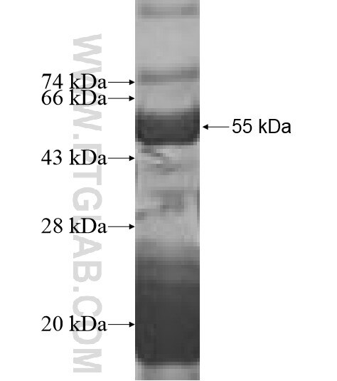 RPL7L1 fusion protein Ag10106 SDS-PAGE