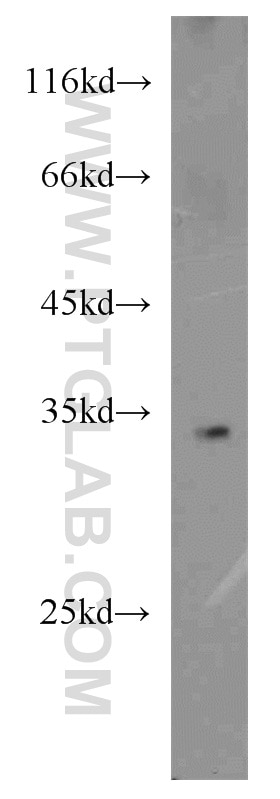 RPL8 Polyclonal antibody