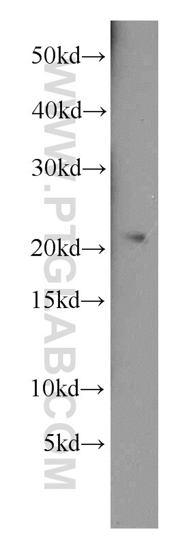 Western Blot (WB) analysis of human brain tissue using RPL9 Polyclonal antibody (14117-1-AP)