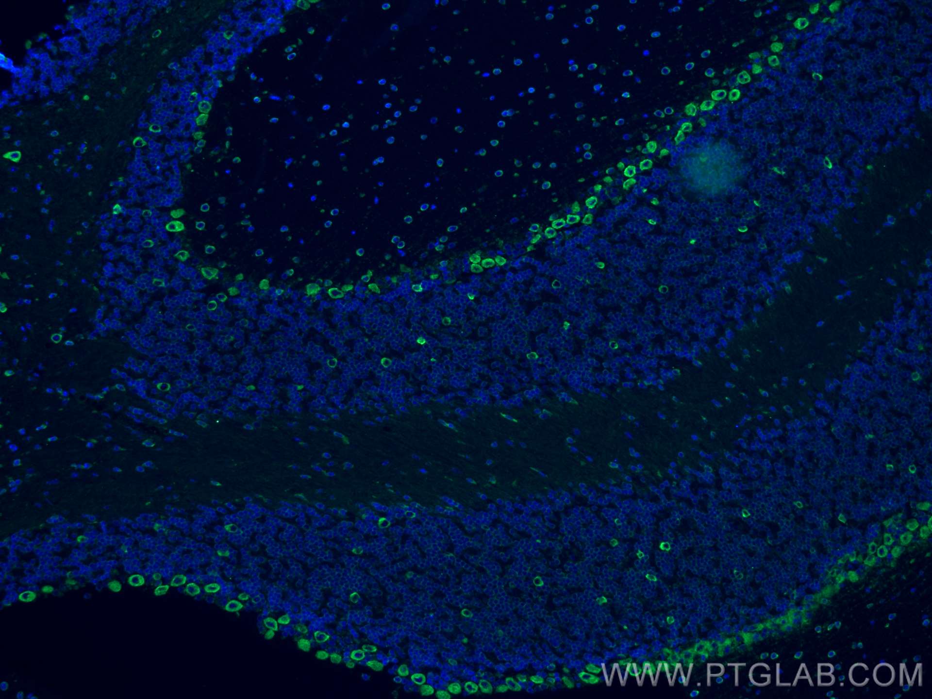 Immunofluorescence (IF) / fluorescent staining of mouse cerebellum tissue using RPL9 Monoclonal antibody (68054-1-Ig)