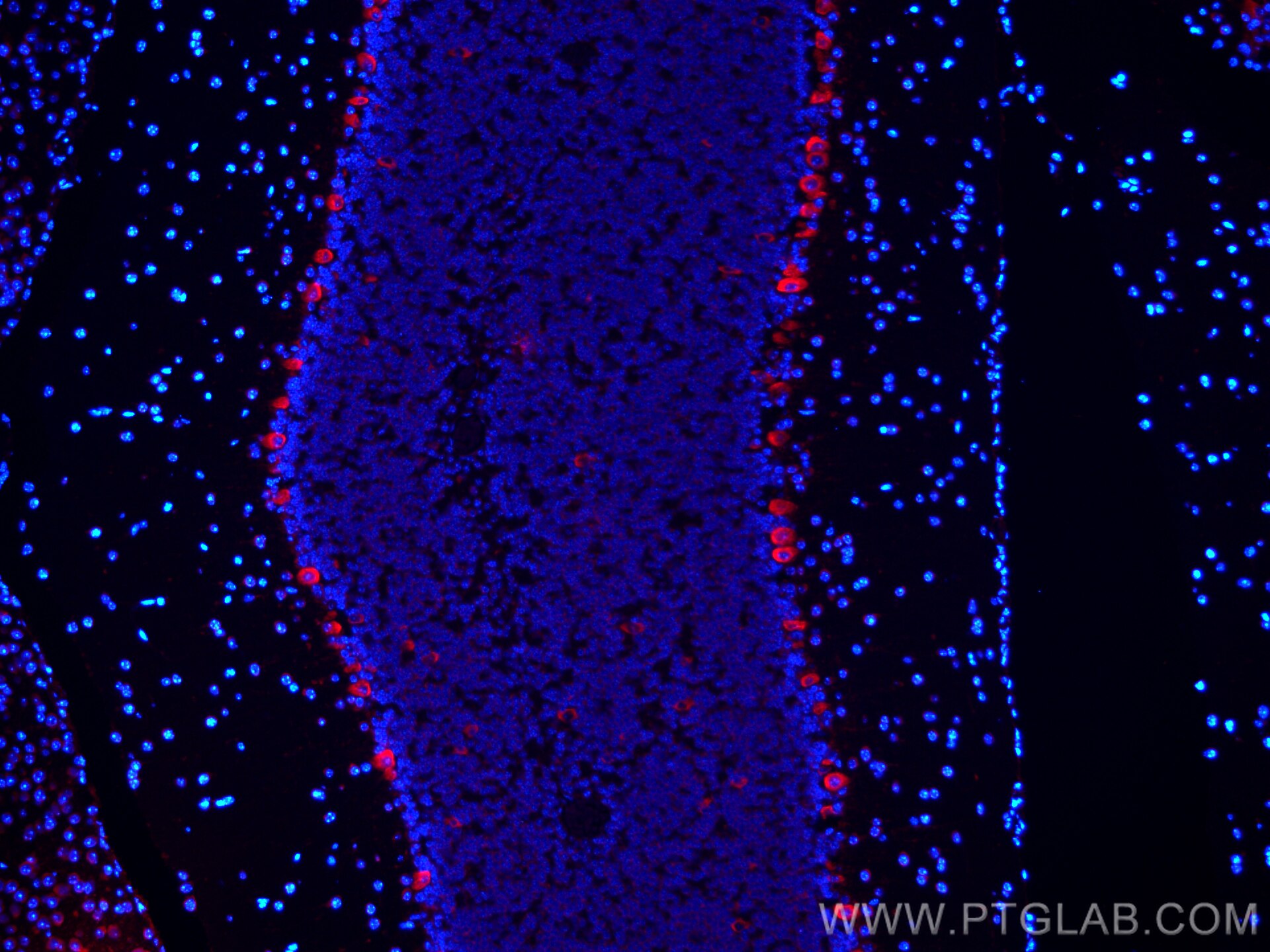 Immunofluorescence (IF) / fluorescent staining of mouse cerebellum tissue using CoraLite®594-conjugated RPL9 Monoclonal antibody (CL594-68054)