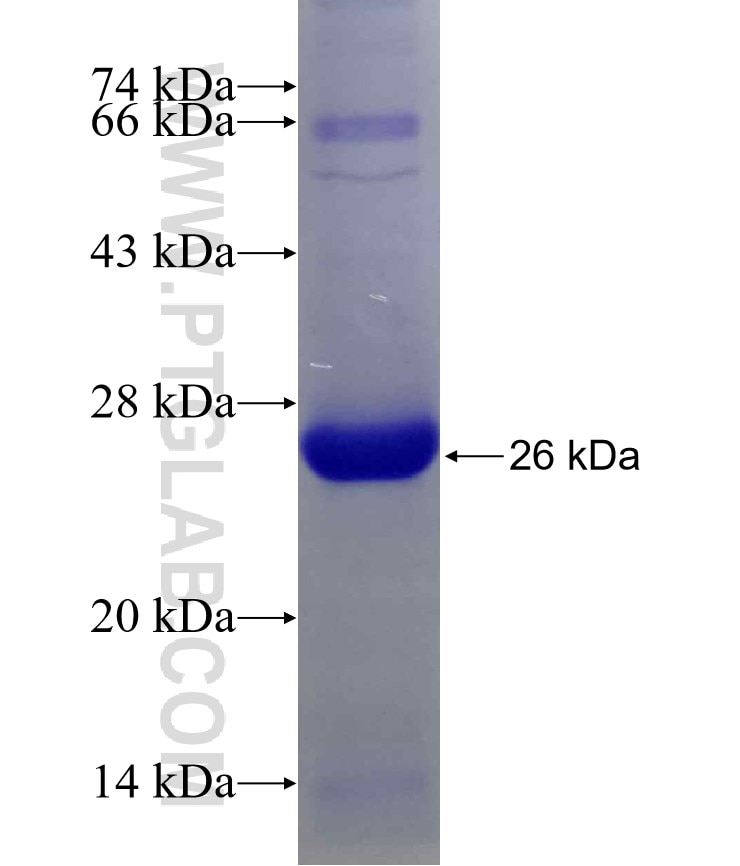 RPL9 fusion protein Ag5391 SDS-PAGE