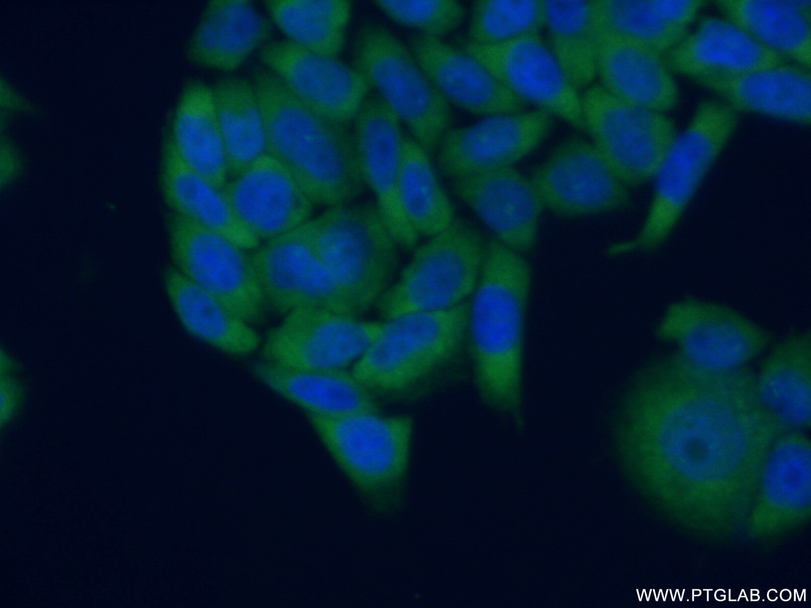 Immunofluorescence (IF) / fluorescent staining of HeLa cells using RPLP0 Polyclonal antibody (11290-2-AP)