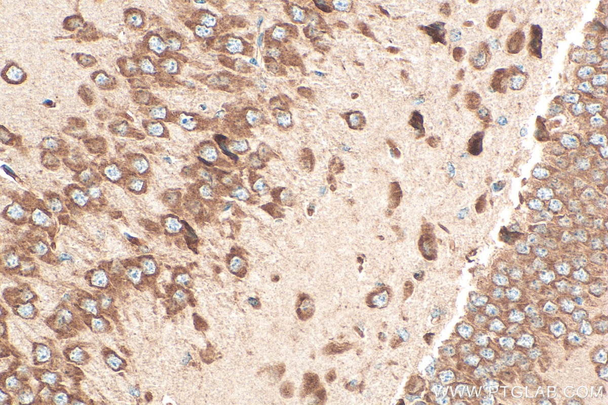 Immunohistochemistry (IHC) staining of mouse brain tissue using RPLP0 Polyclonal antibody (11290-2-AP)