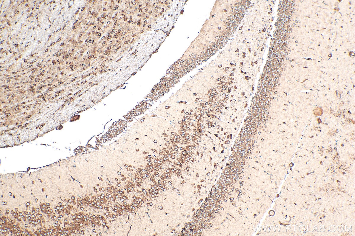 Immunohistochemistry (IHC) staining of mouse brain tissue using RPLP0 Polyclonal antibody (11290-2-AP)