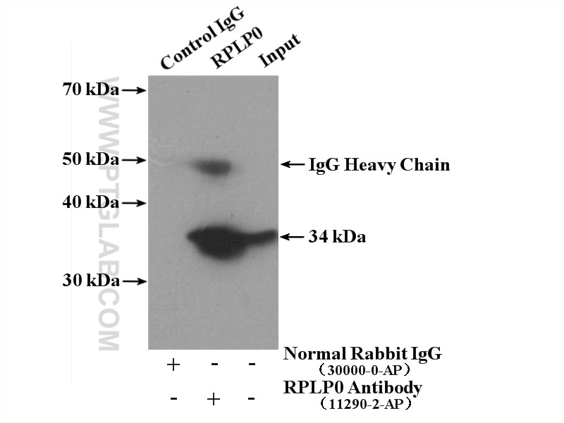 Immunoprecipitation (IP) experiment of HeLa cells using RPLP0 Polyclonal antibody (11290-2-AP)