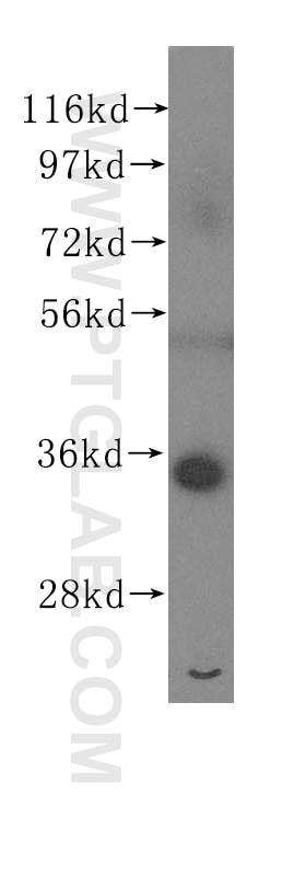 RPLP0 Polyclonal antibody