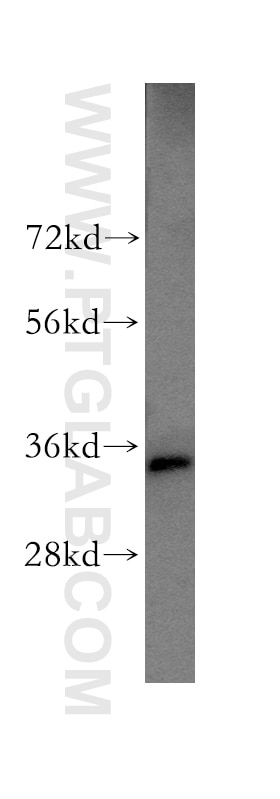 Western Blot (WB) analysis of HEK-293 cells using RPLP0 Polyclonal antibody (51019-2-AP)