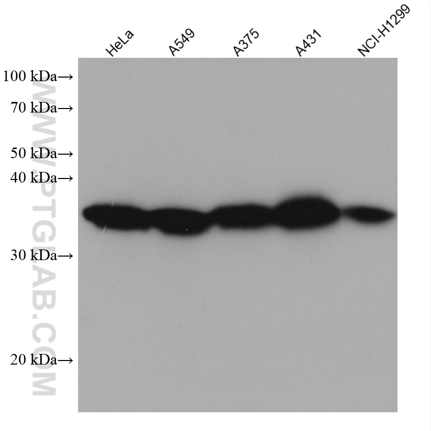 Western Blot (WB) analysis of various lysates using RPLP0 Monoclonal antibody (68056-1-Ig)