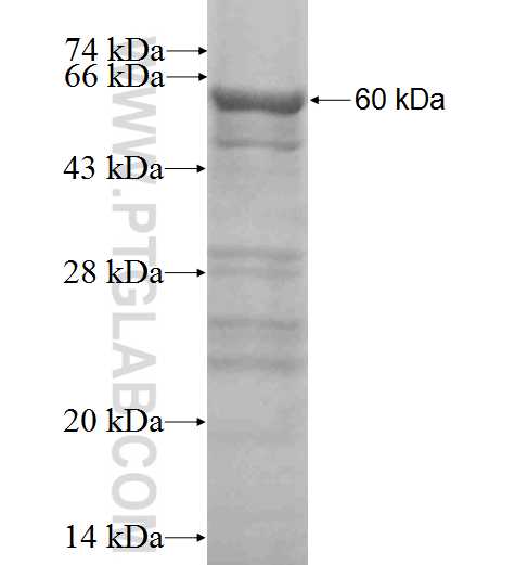 RPLP0 fusion protein Ag1829 SDS-PAGE