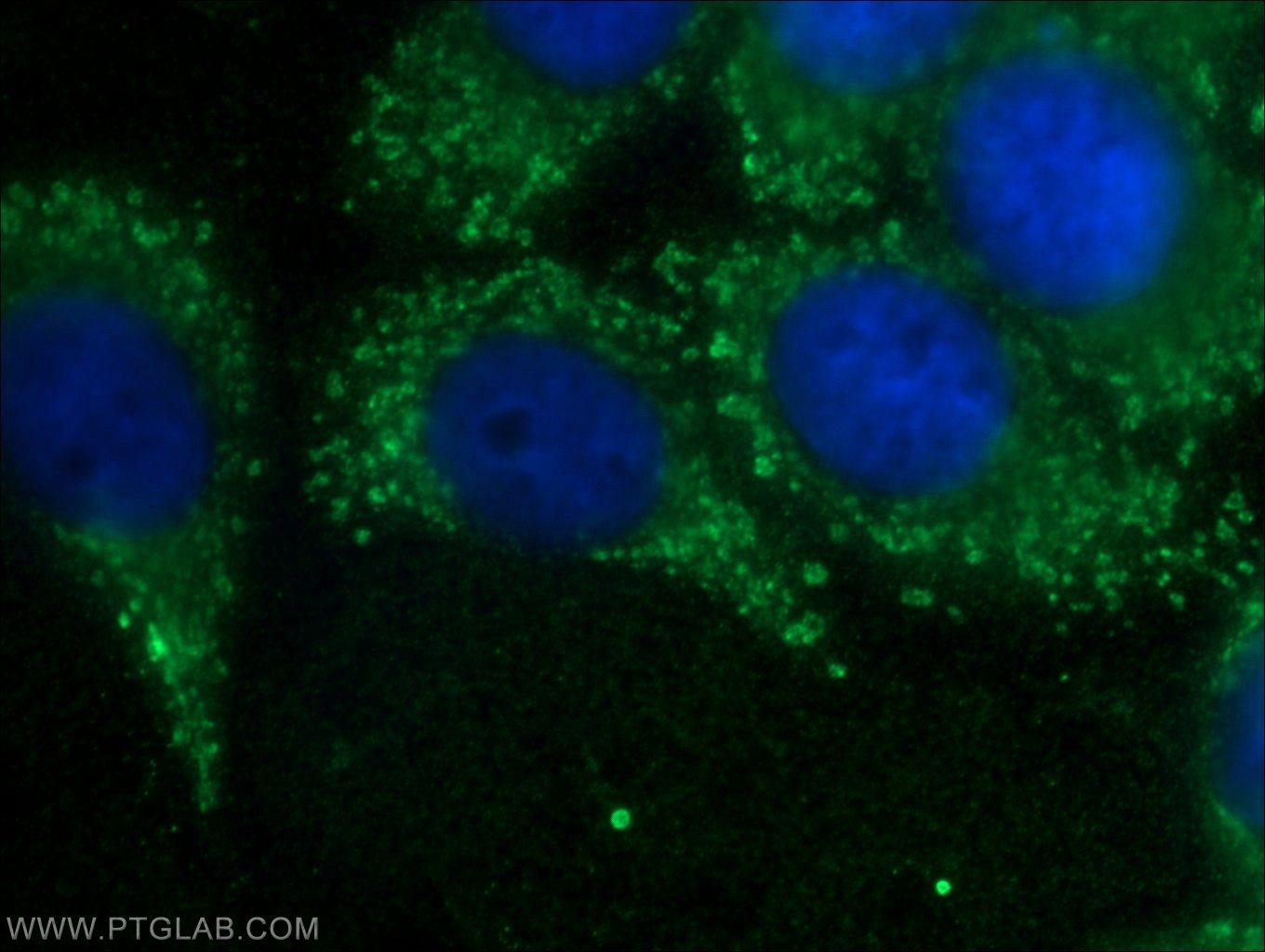 Immunofluorescence (IF) / fluorescent staining of HepG2 cells using RPLP1 Polyclonal antibody (21636-1-AP)