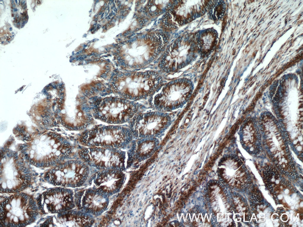 Immunohistochemistry (IHC) staining of human colon tissue using RPLP1 Polyclonal antibody (21636-1-AP)