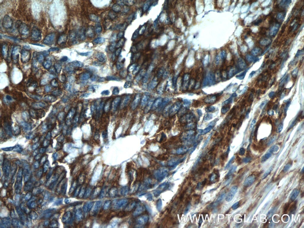 Immunohistochemistry (IHC) staining of human colon tissue using RPLP1 Polyclonal antibody (21636-1-AP)