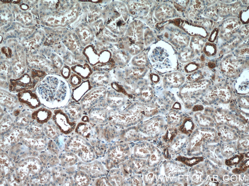 Immunohistochemistry (IHC) staining of human kidney tissue using RPLP1 Polyclonal antibody (21636-1-AP)