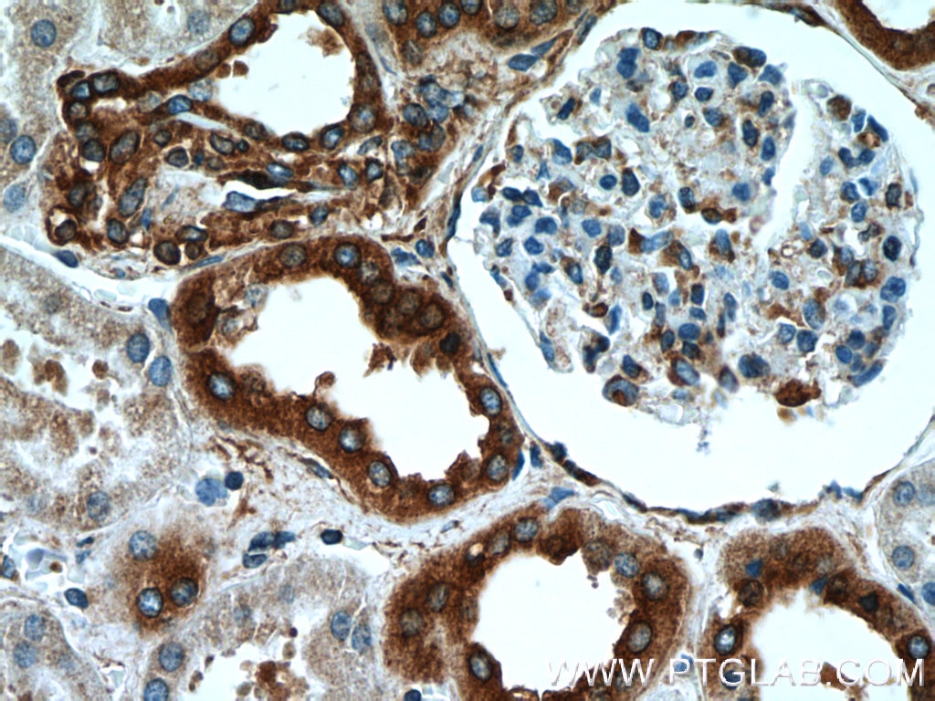Immunohistochemistry (IHC) staining of human kidney tissue using RPLP1 Polyclonal antibody (21636-1-AP)