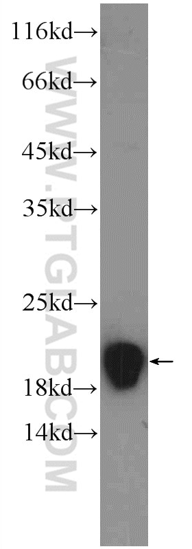 Western Blot (WB) analysis of HepG2 cells using RPLP1 Polyclonal antibody (21636-1-AP)