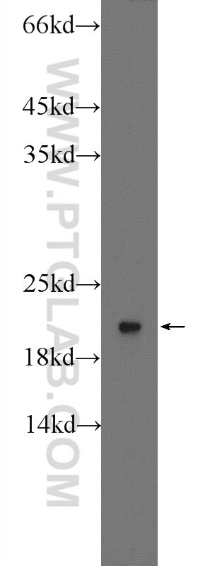 Western Blot (WB) analysis of HeLa cells using RPLP1 Polyclonal antibody (21636-1-AP)