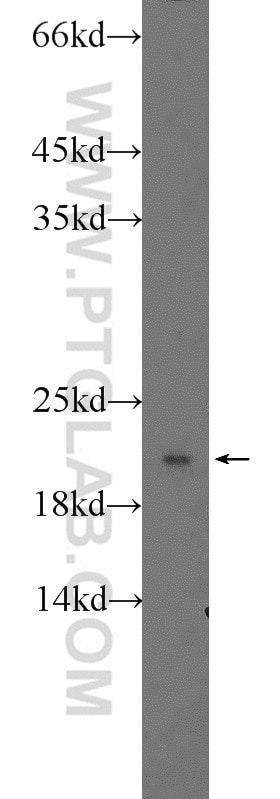 Western Blot (WB) analysis of HeLa cells using RPLP1 Polyclonal antibody (21636-1-AP)