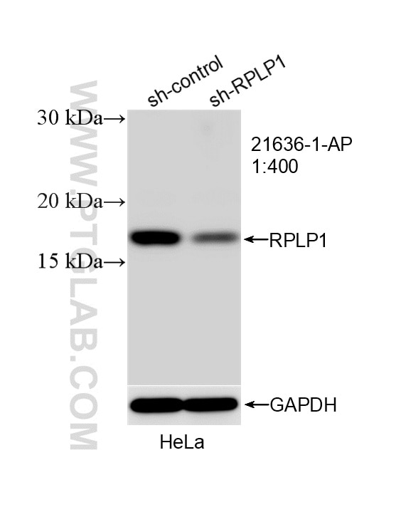 WB result of RPLP1 antibody (21636-1-AP; 1:400; incubated at room temperature for 1.5 hours) with sh-Control and sh-RPLP1 transfected HeLa cells. Western Blot (WB) analysis of HeLa cells using RPLP1 Polyclonal antibody (21636-1-AP)