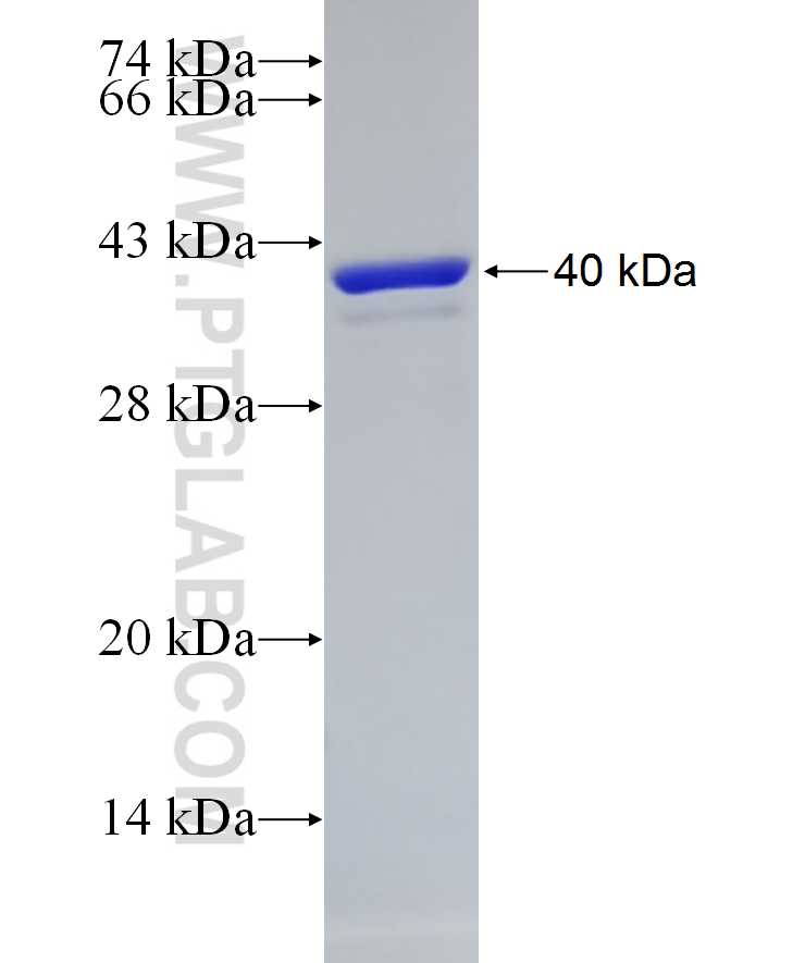 RPLP1 fusion protein Ag16268 SDS-PAGE