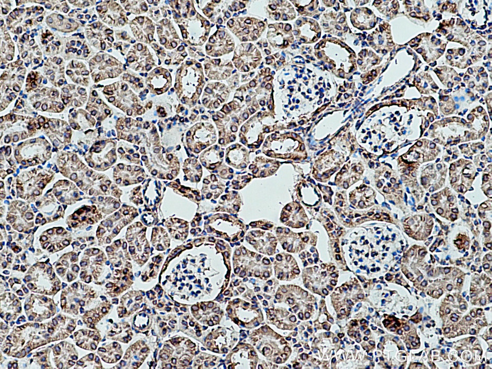 Immunohistochemistry (IHC) staining of mouse kidney tissue using RPLP2 Polyclonal antibody (16805-1-AP)