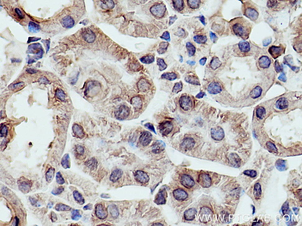 Immunohistochemistry (IHC) staining of mouse kidney tissue using RPLP2 Polyclonal antibody (16805-1-AP)