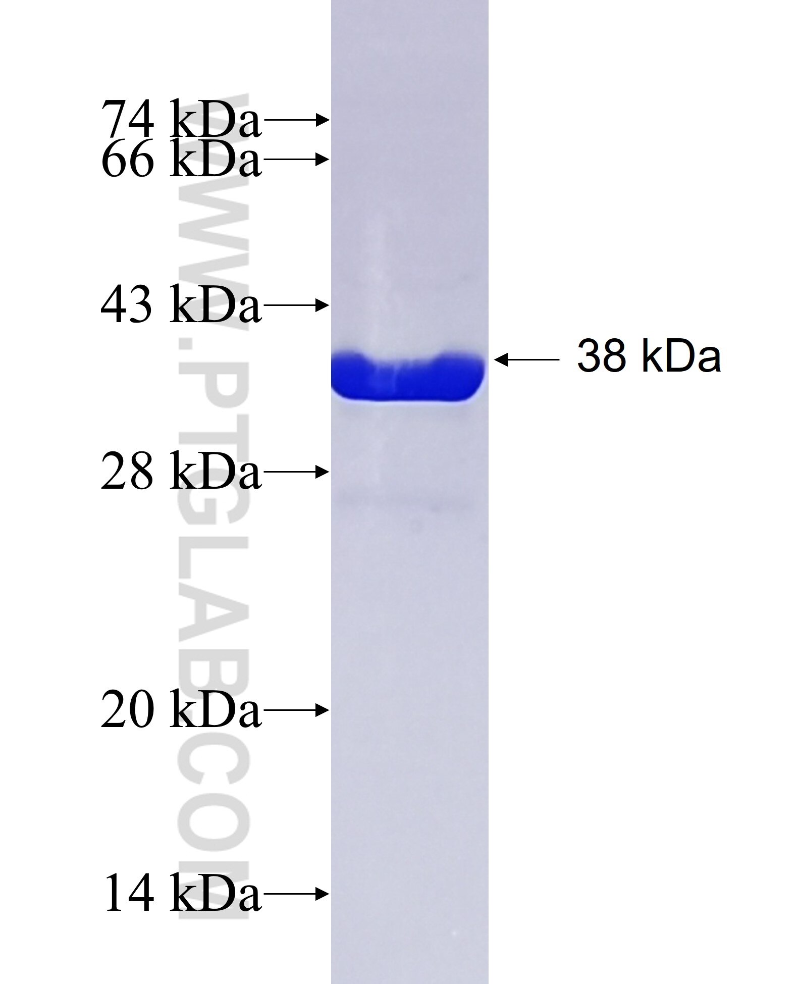 RPLP2 fusion protein Ag29455 SDS-PAGE