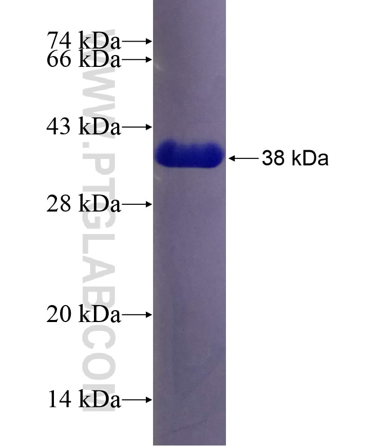 RPLP2 fusion protein Ag10293 SDS-PAGE