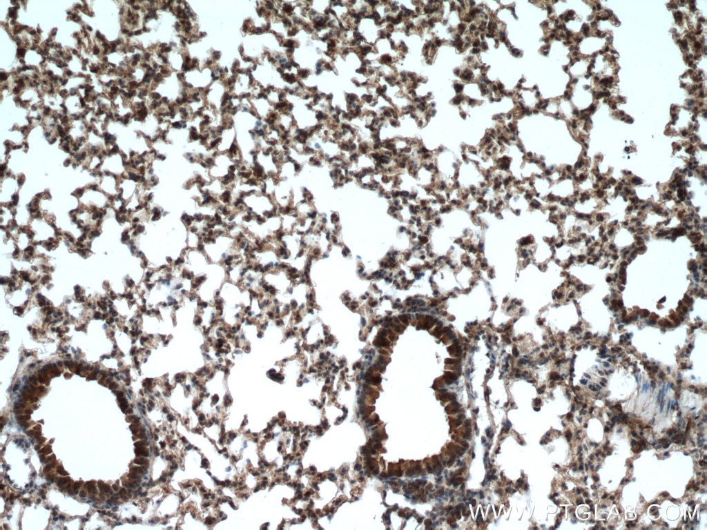 Immunohistochemistry (IHC) staining of mouse lung tissue using RPN1 Polyclonal antibody (12894-1-AP)