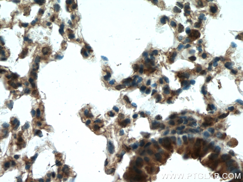 Immunohistochemistry (IHC) staining of mouse lung tissue using RPN1 Polyclonal antibody (12894-1-AP)