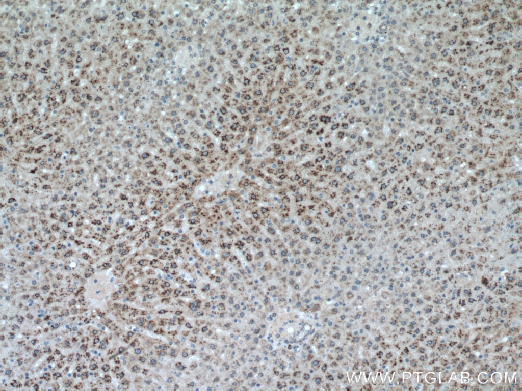 Immunohistochemistry (IHC) staining of rat liver tissue using RPN1 Polyclonal antibody (12894-1-AP)