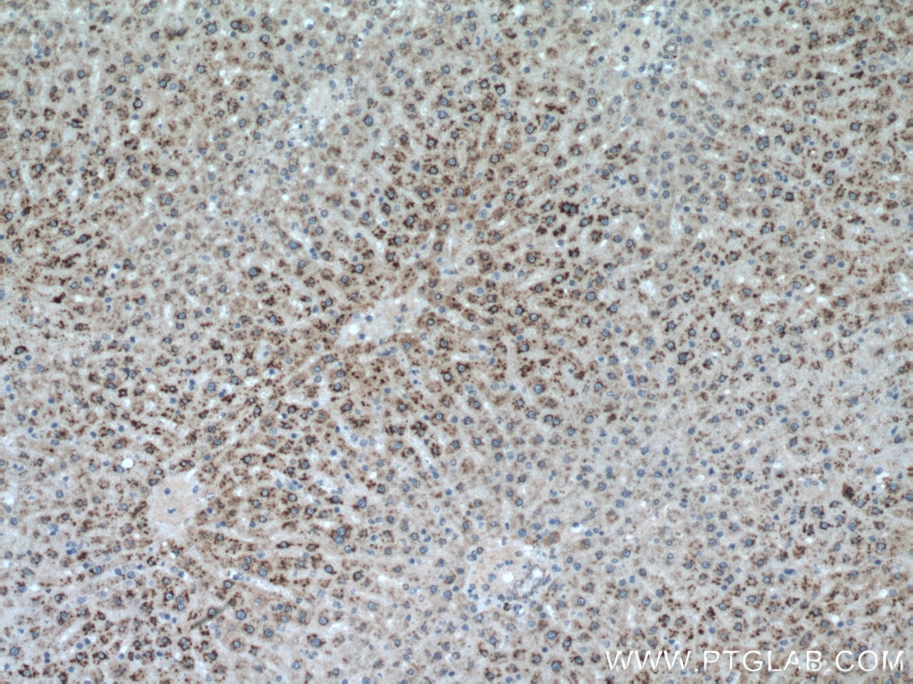 IHC staining of rat liver using 12894-1-AP