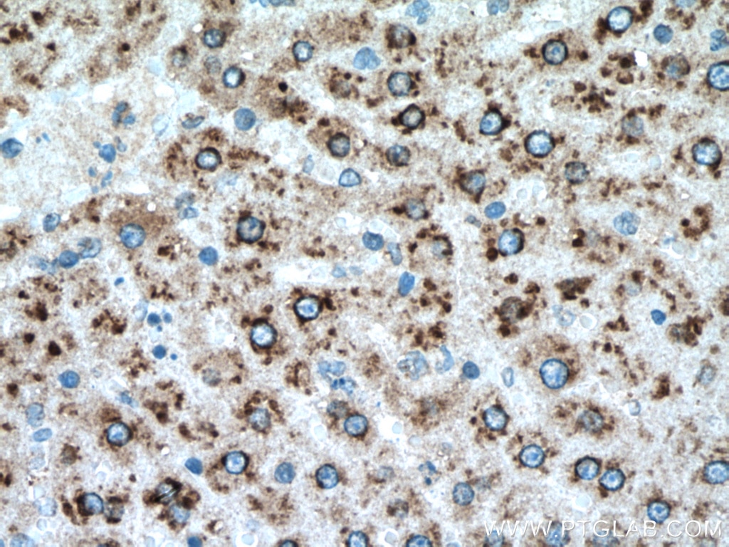 Immunohistochemistry (IHC) staining of rat liver tissue using RPN1 Polyclonal antibody (12894-1-AP)