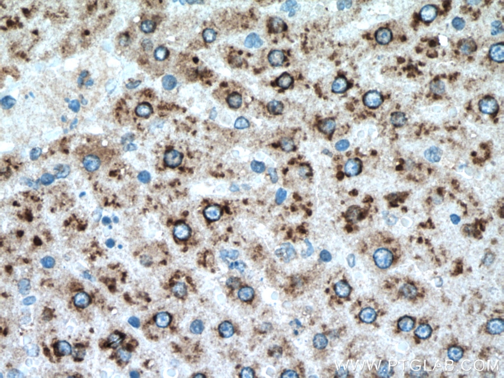 IHC staining of rat liver using 12894-1-AP