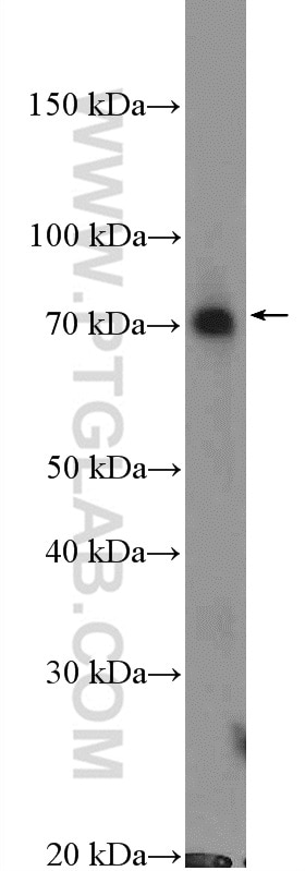Western Blot (WB) analysis of K-562 cells using RPN1 Polyclonal antibody (12894-1-AP)