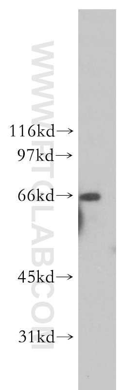 Western Blot (WB) analysis of HeLa cells using RPN1 Polyclonal antibody (12894-1-AP)