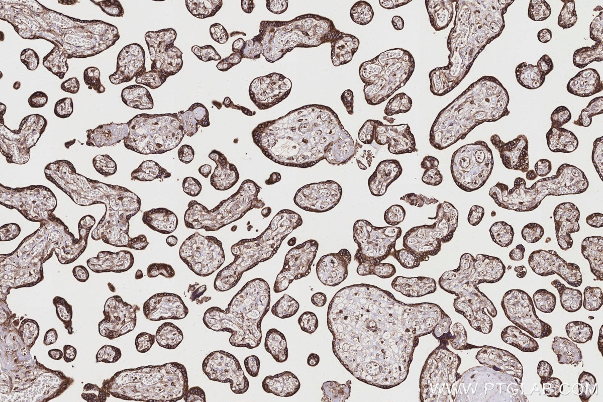 IHC staining of human placenta using 83250-2-RR Immunohistochemistry (IHC) staining of human placenta tissue using Ribophorin I Recombinant monoclonal antibody (83250-2-RR)