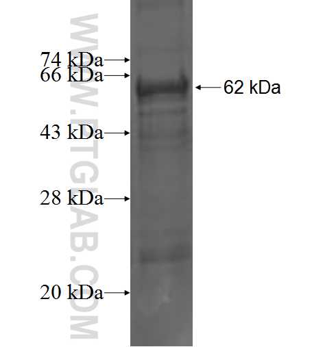 RPN1 fusion protein Ag3576 SDS-PAGE