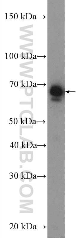 Western Blot (WB) analysis of NIH/3T3 cells using RPN2 Polyclonal antibody (10576-1-AP)