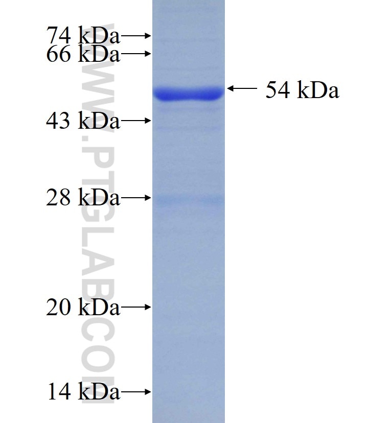 RPN2 fusion protein Ag0862 SDS-PAGE