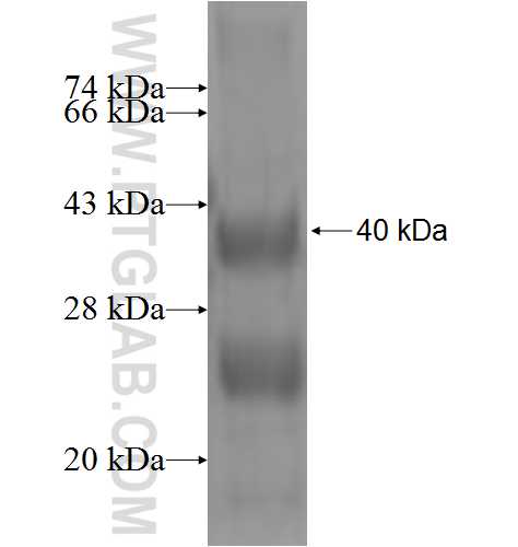 RPP14 fusion protein Ag4159 SDS-PAGE