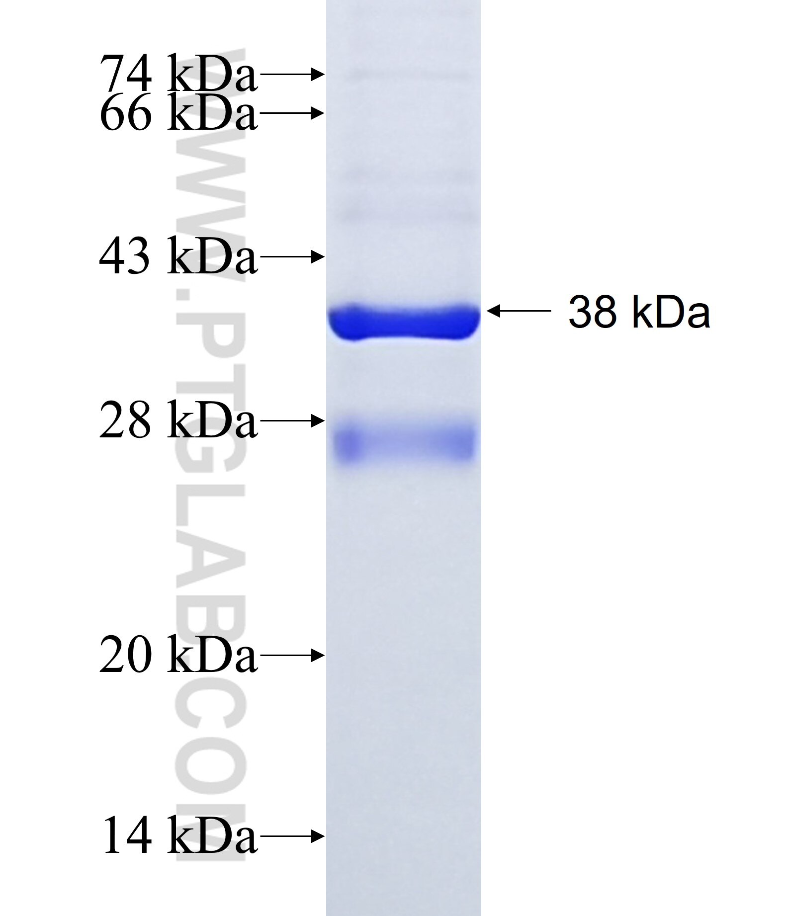 RPP14 fusion protein Ag4159 SDS-PAGE