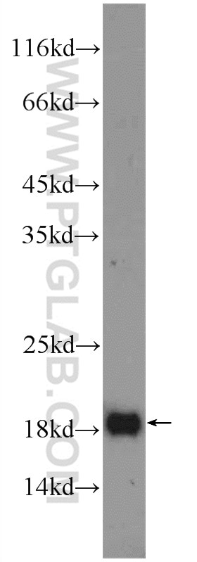 WB analysis of COLO 320 using 16377-1-AP