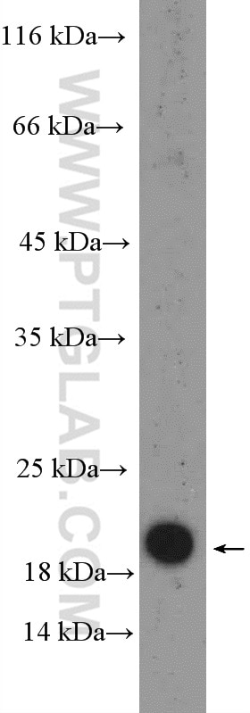 Western Blot (WB) analysis of COLO 320 cells using RPP21 Polyclonal antibody (16377-1-AP)